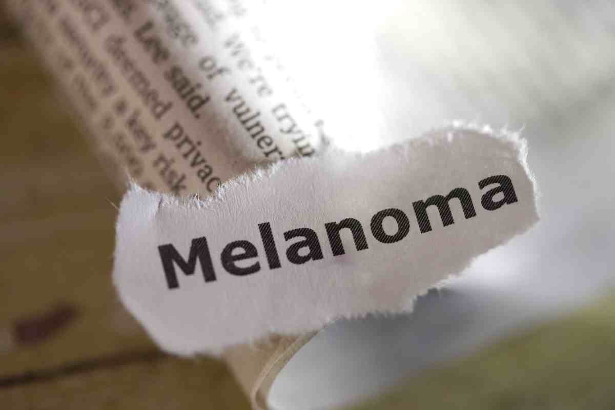 melanoma cos'è