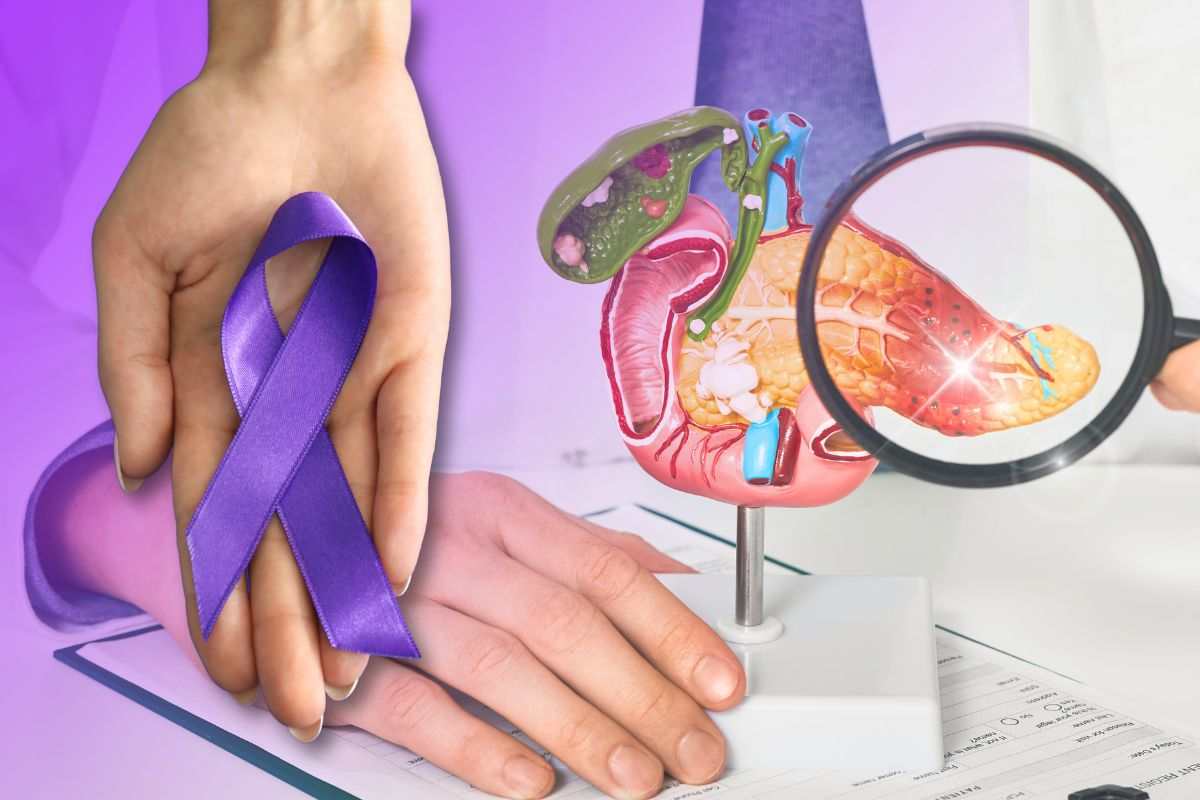 tumore pancreas