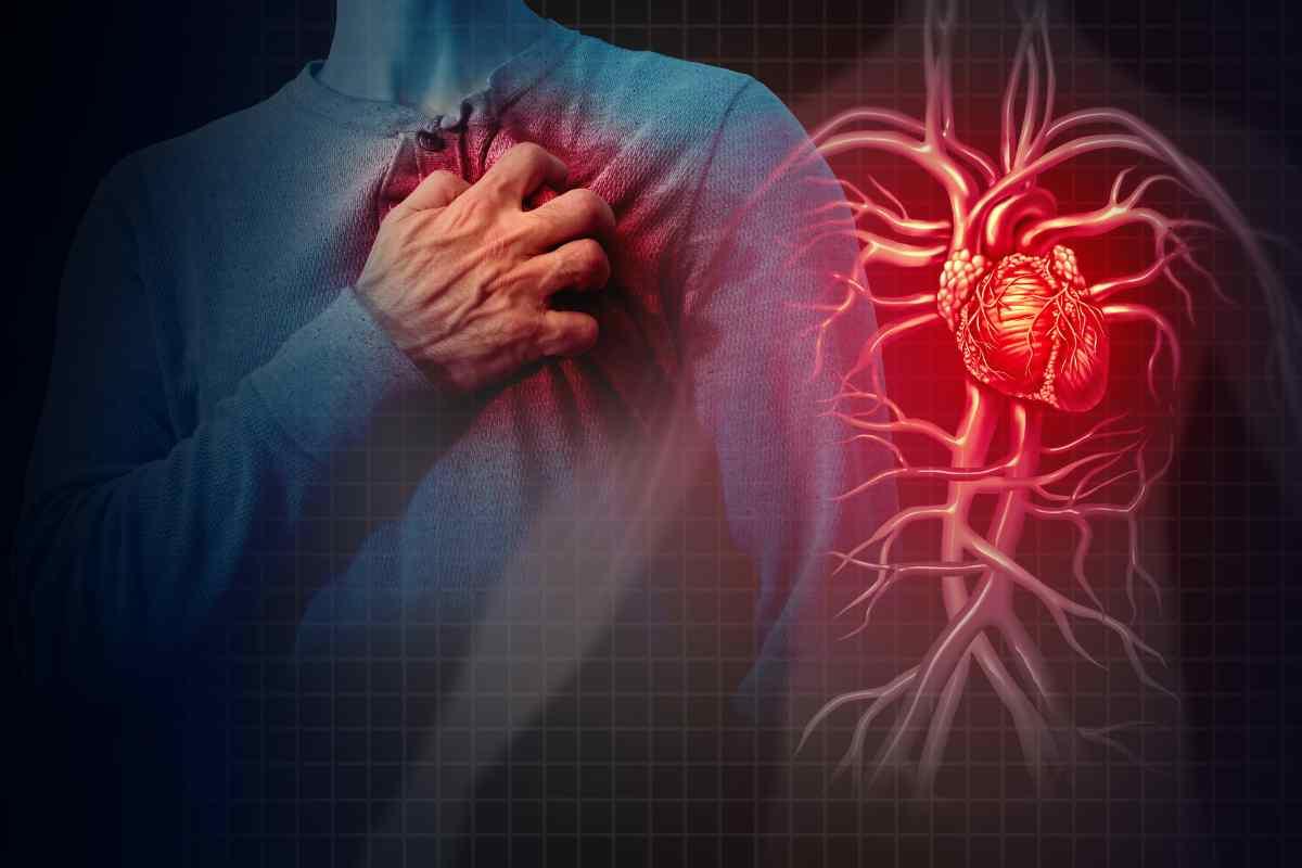 I sintomi dell'infarto del miocardio 