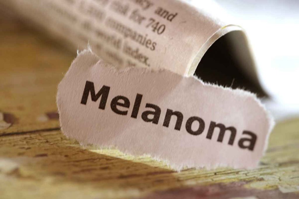 sintomi melanoma dell'occhio