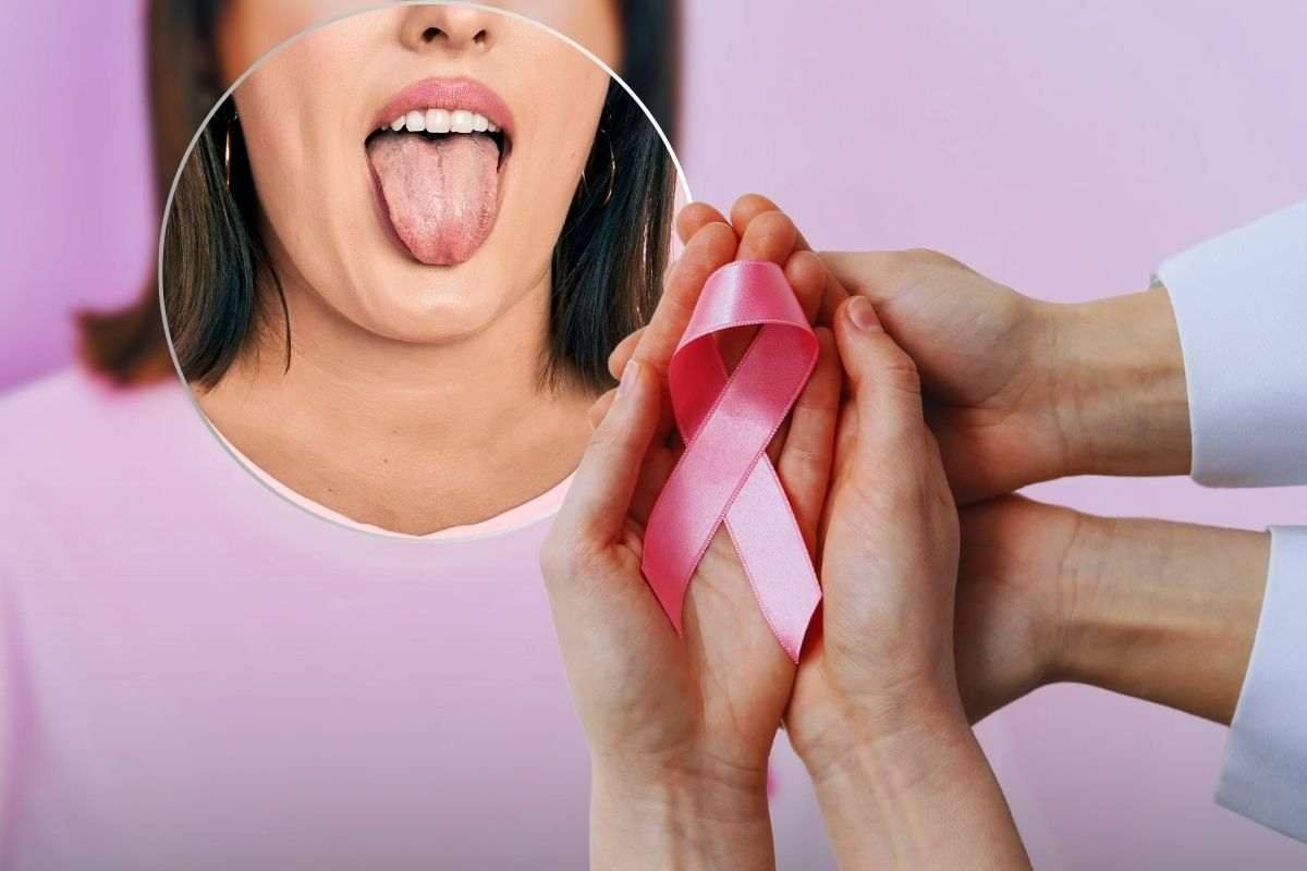 Cancro lingua: sintomi cure