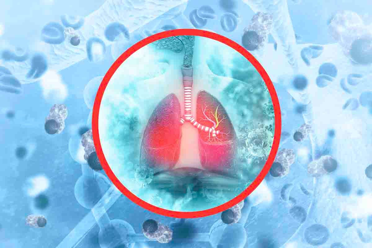 I segnali del tumore al polmone