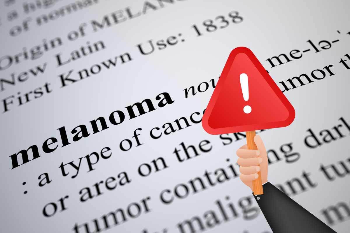 come prevenire il melanoma