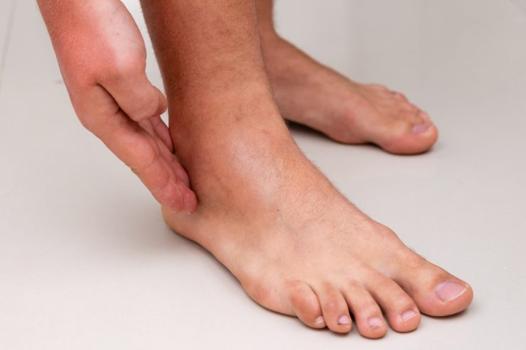 Caviglie gonfie causa malattie