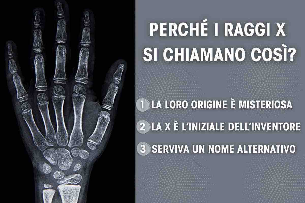 Raggi X perchè si chiamano in questo modo 