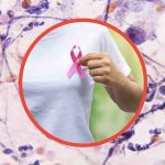 conoscere Sintomi tumore al seno