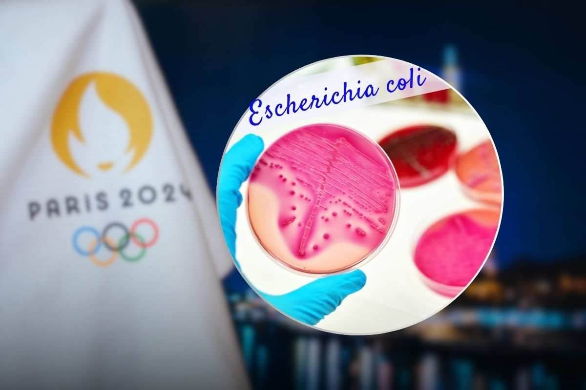 Sintomi e cura dell'Escherichia Coli